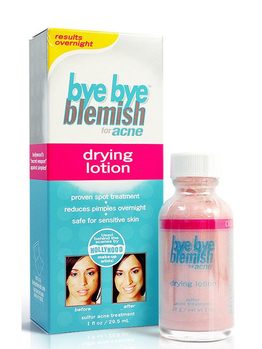 Bye Bye Blemish For Acne Drying Lotion (28 g)